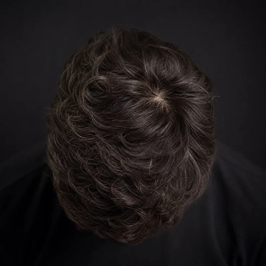 Illustrative top-of-crown baseline scan example