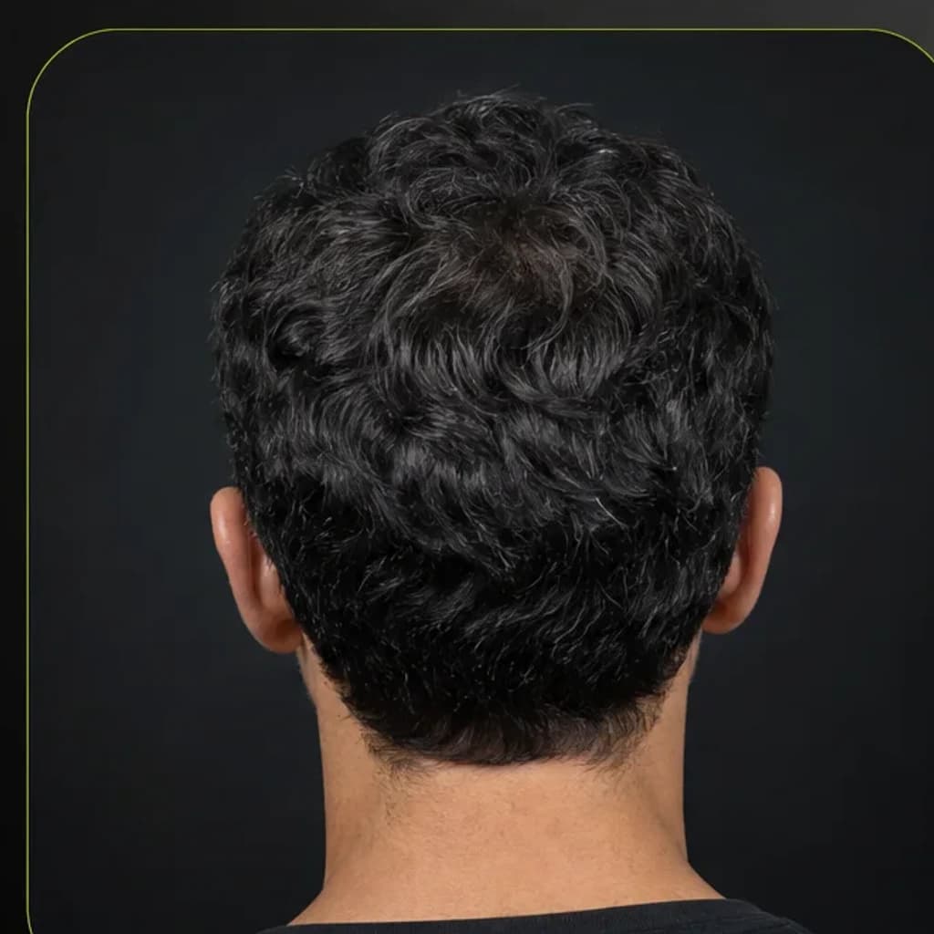 Back-of-head guided scan angle