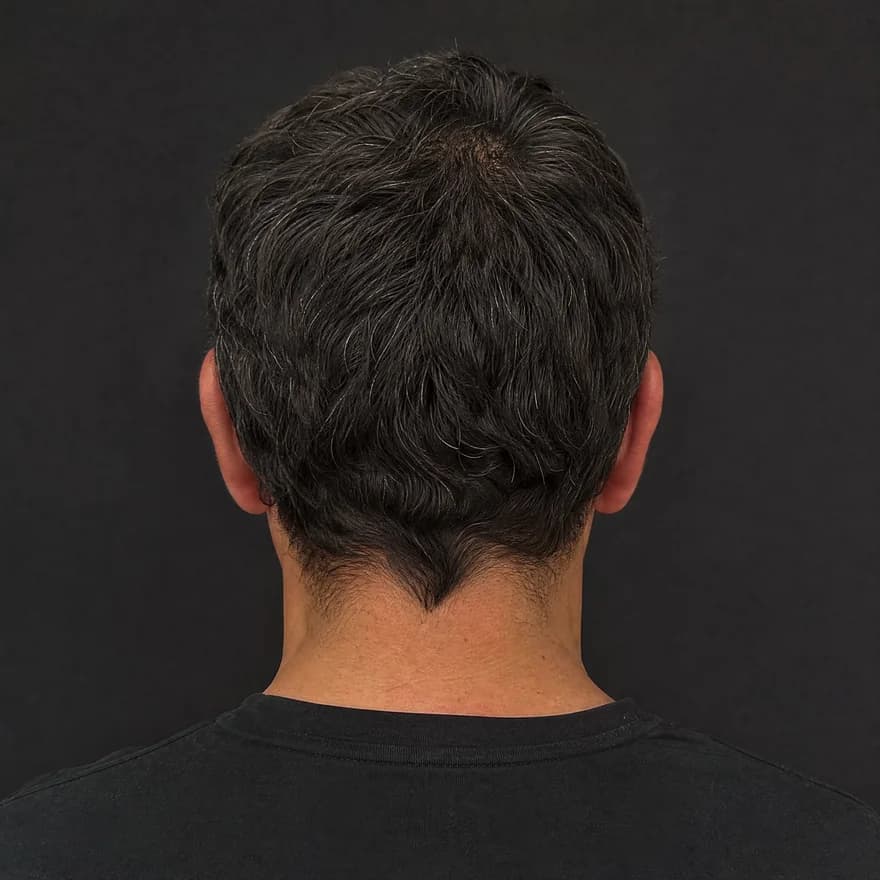 Back-of-head guided scan angle